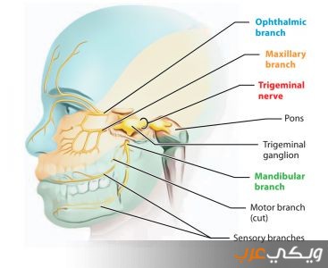 ما هو العصب الخامس وما أسبابه وعلاجه ويكي عرب