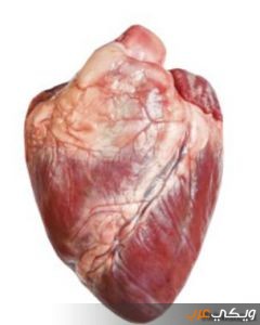 ما هي أمراض القلب الوعائية