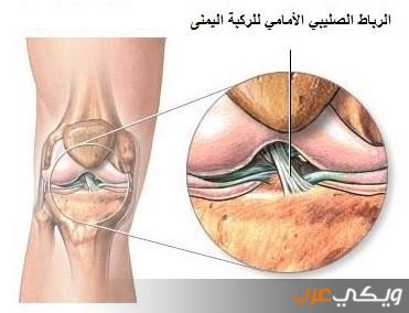 الرباط الصليبي الامامي اهم أسبابه و أعراضه و كيفية علاجه