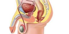 سرطان البروستات أسبابه و أعراضه و كيفية تشخيصه و علاجه