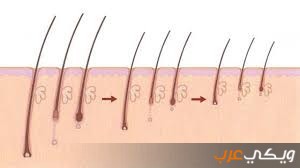 علاج موت بصيلات الشعر وتساقطه ويكي عرب